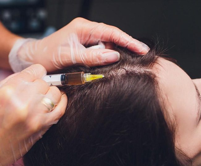 مزوتراپی مو چیست و تاثیر مزوتراپی بعد از کاشت مو